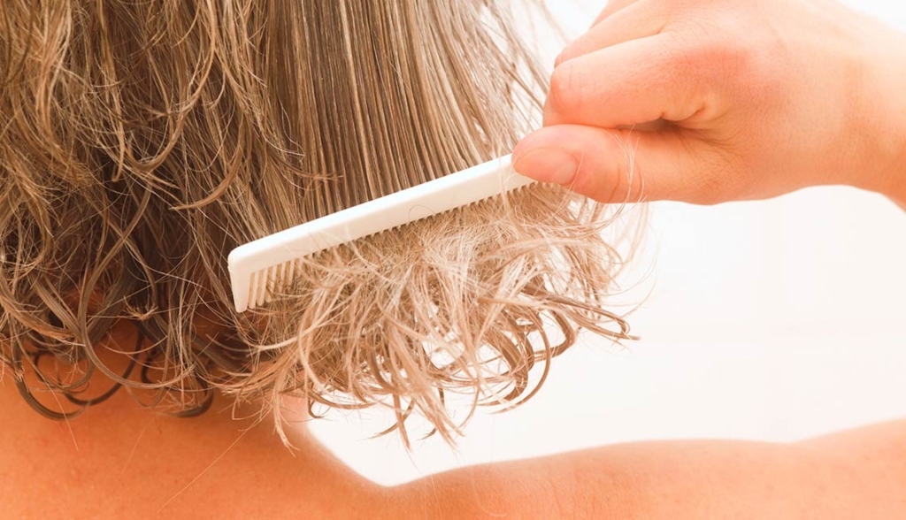 1. Causes of Thinning Hair in Women - wide 2